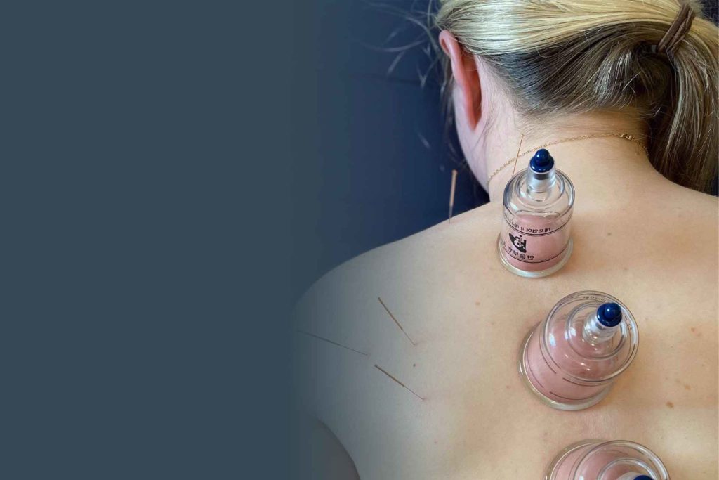 What is Myotherapy